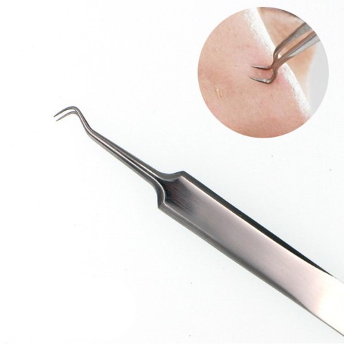 acne pinzette in Acciaio Inox per eliminare l'acne Punti Neri Brufoli acne pinzette in Acciaio Inox per eliminare l'acne Punti Neri Brufoli