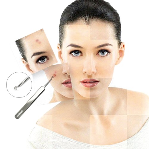 acne pinzette in Acciaio Inox per eliminare l'acne Punti Neri Brufoli acne pinzette in Acciaio Inox per eliminare l'acne Punti Neri Brufoli